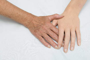 αναζωογόνηση του δέρματος των χεριών